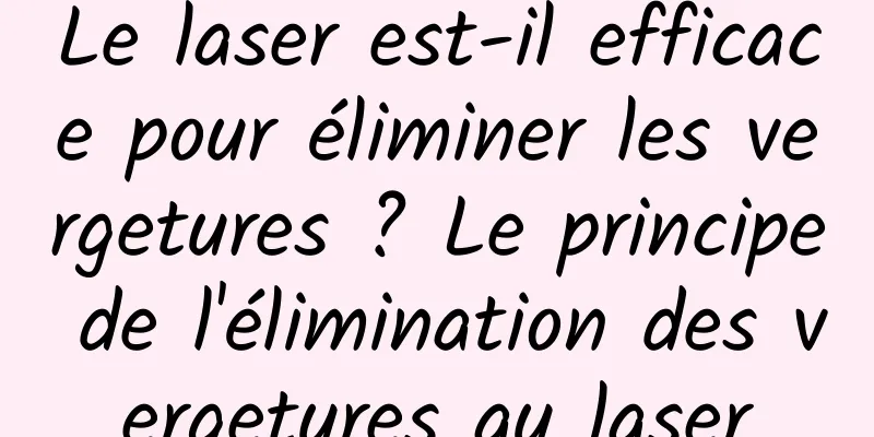 Le laser est-il efficace pour éliminer les vergetures ? Le principe de l'élimination des vergetures au laser