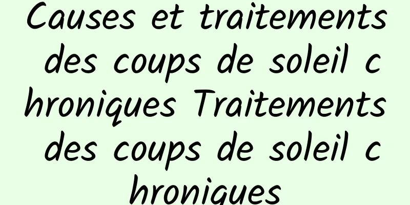 Causes et traitements des coups de soleil chroniques Traitements des coups de soleil chroniques