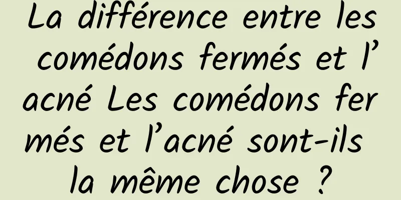La différence entre les comédons fermés et l’acné Les comédons fermés et l’acné sont-ils la même chose ?