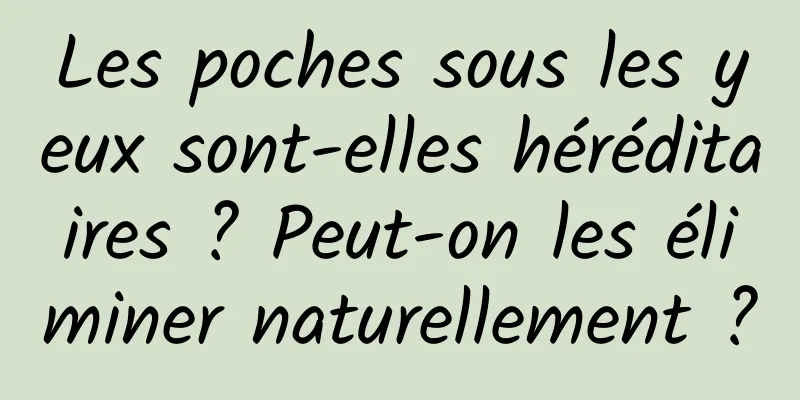 Les poches sous les yeux sont-elles héréditaires ? Peut-on les éliminer naturellement ?