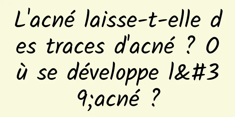 L'acné laisse-t-elle des traces d'acné ? Où se développe l'acné ?