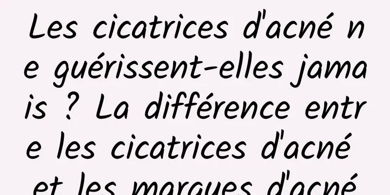 Les cicatrices d'acné ne guérissent-elles jamais ? La différence entre les cicatrices d'acné et les marques d'acné
