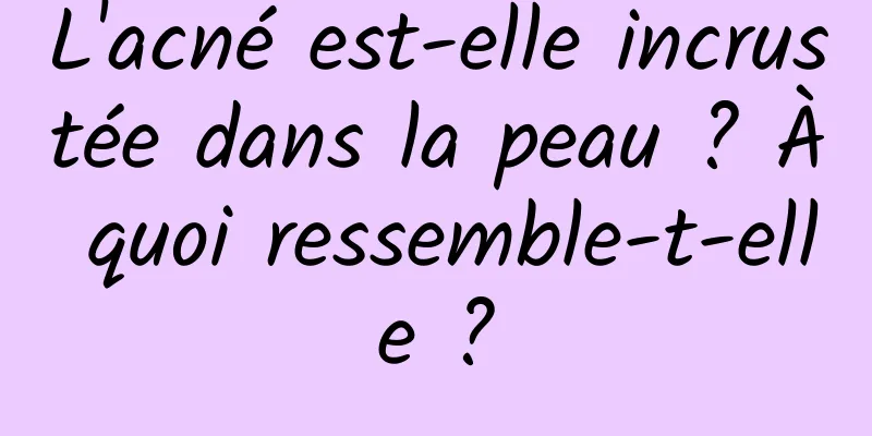 L'acné est-elle incrustée dans la peau ? À quoi ressemble-t-elle ?