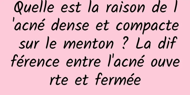 Quelle est la raison de l'acné dense et compacte sur le menton ? La différence entre l'acné ouverte et fermée