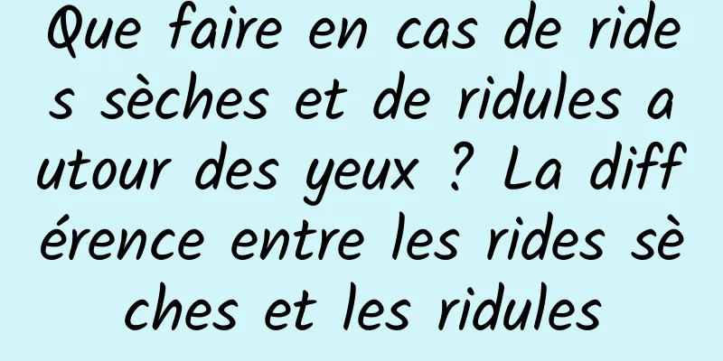 Que faire en cas de rides sèches et de ridules autour des yeux ? La différence entre les rides sèches et les ridules