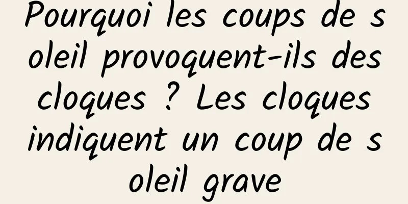 Pourquoi les coups de soleil provoquent-ils des cloques ? Les cloques indiquent un coup de soleil grave