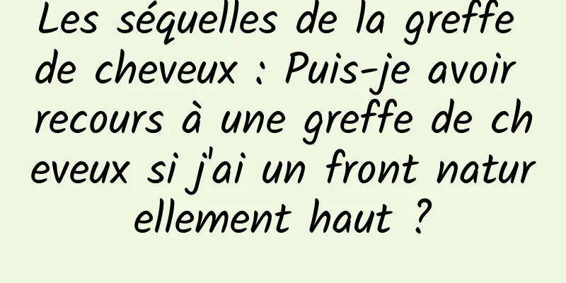 Les séquelles de la greffe de cheveux : Puis-je avoir recours à une greffe de cheveux si j'ai un front naturellement haut ?