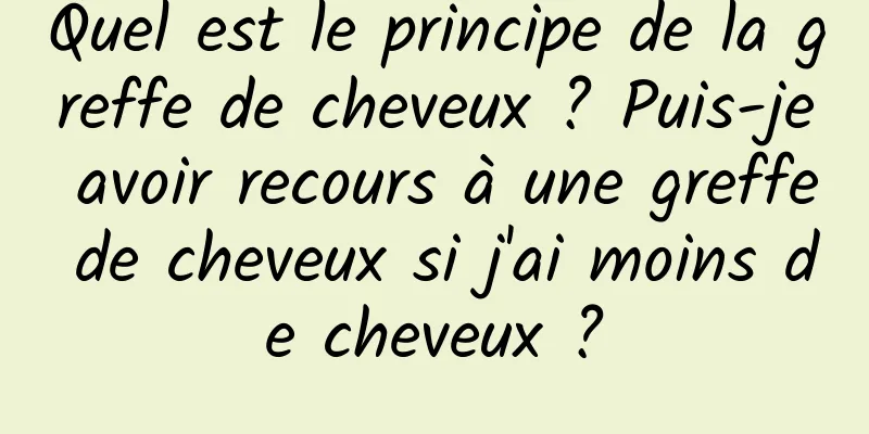 Quel est le principe de la greffe de cheveux ? Puis-je avoir recours à une greffe de cheveux si j'ai moins de cheveux ?