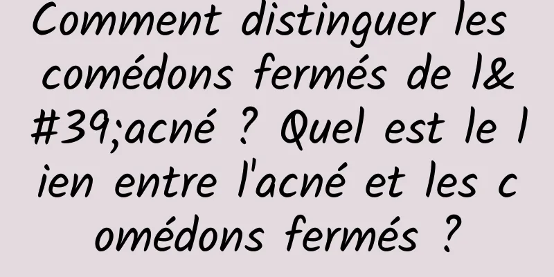 Comment distinguer les comédons fermés de l'acné ? Quel est le lien entre l'acné et les comédons fermés ?
