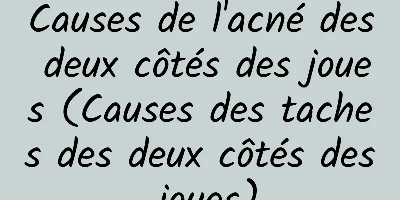 Causes de l'acné des deux côtés des joues (Causes des taches des deux côtés des joues)