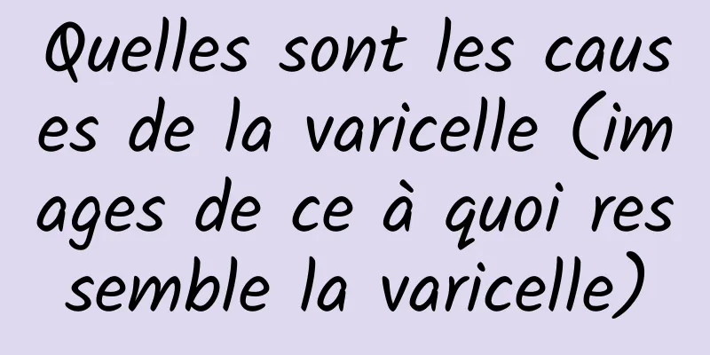 Quelles sont les causes de la varicelle (images de ce à quoi ressemble la varicelle)