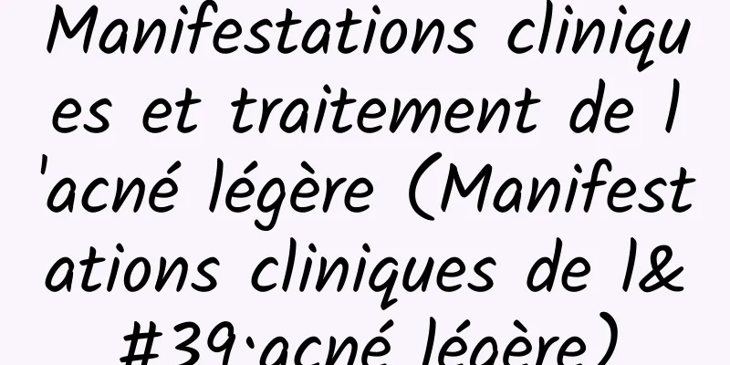 Manifestations cliniques et traitement de l'acné légère (Manifestations cliniques de l'acné légère)