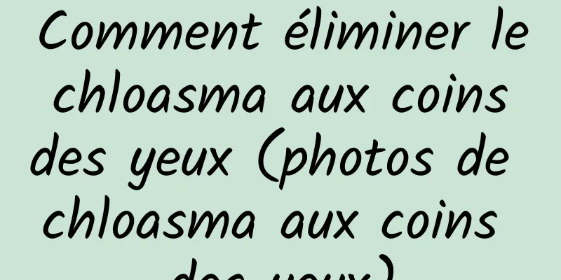 Comment éliminer le chloasma aux coins des yeux (photos de chloasma aux coins des yeux)