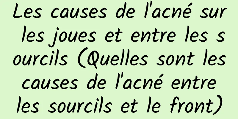 Les causes de l'acné sur les joues et entre les sourcils (Quelles sont les causes de l'acné entre les sourcils et le front)