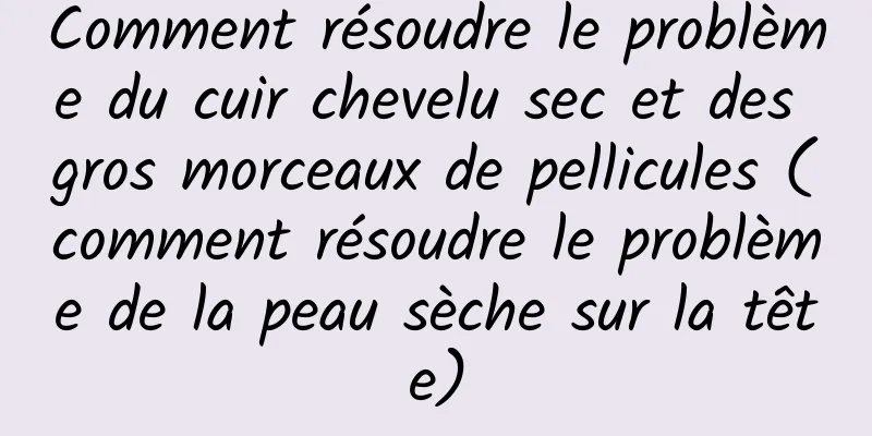Comment résoudre le problème du cuir chevelu sec et des gros morceaux de pellicules (comment résoudre le problème de la peau sèche sur la tête)