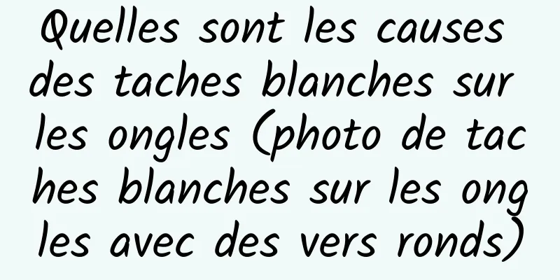 Quelles sont les causes des taches blanches sur les ongles (photo de taches blanches sur les ongles avec des vers ronds)
