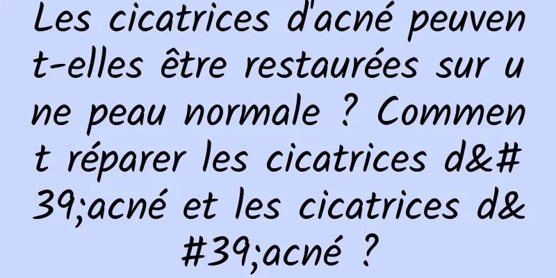 Les cicatrices d'acné peuvent-elles être restaurées sur une peau normale ? Comment réparer les cicatrices d'acné et les cicatrices d'acné ?