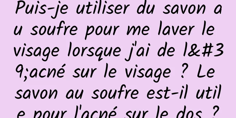 Puis-je utiliser du savon au soufre pour me laver le visage lorsque j'ai de l'acné sur le visage ? Le savon au soufre est-il utile pour l'acné sur le dos ?