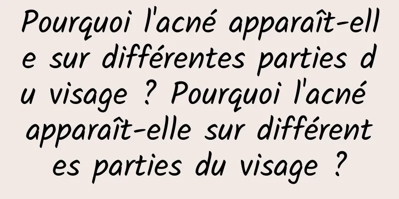 Pourquoi l'acné apparaît-elle sur différentes parties du visage ? Pourquoi l'acné apparaît-elle sur différentes parties du visage ?