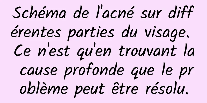 Schéma de l'acné sur différentes parties du visage. Ce n'est qu'en trouvant la cause profonde que le problème peut être résolu.