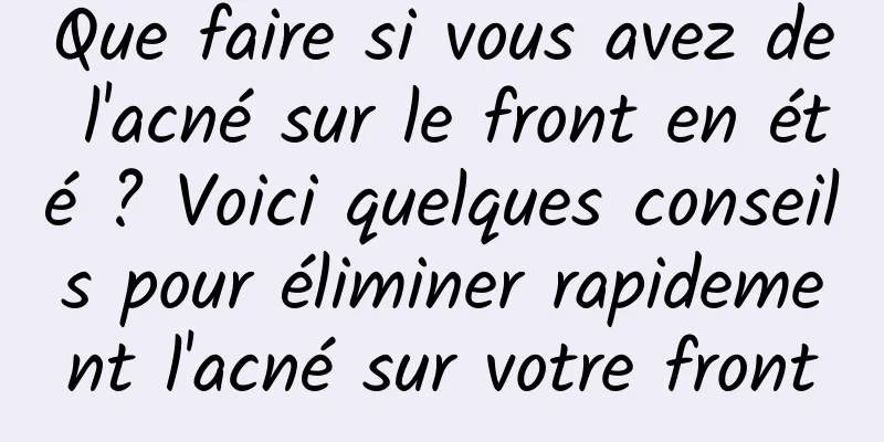 Que faire si vous avez de l'acné sur le front en été ? Voici quelques conseils pour éliminer rapidement l'acné sur votre front