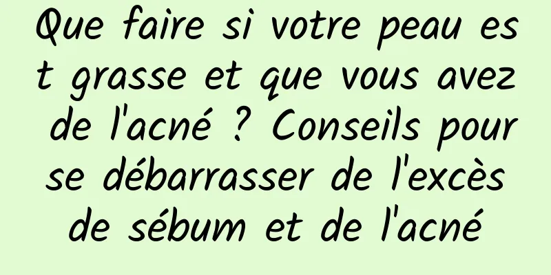 Que faire si votre peau est grasse et que vous avez de l'acné ? Conseils pour se débarrasser de l'excès de sébum et de l'acné